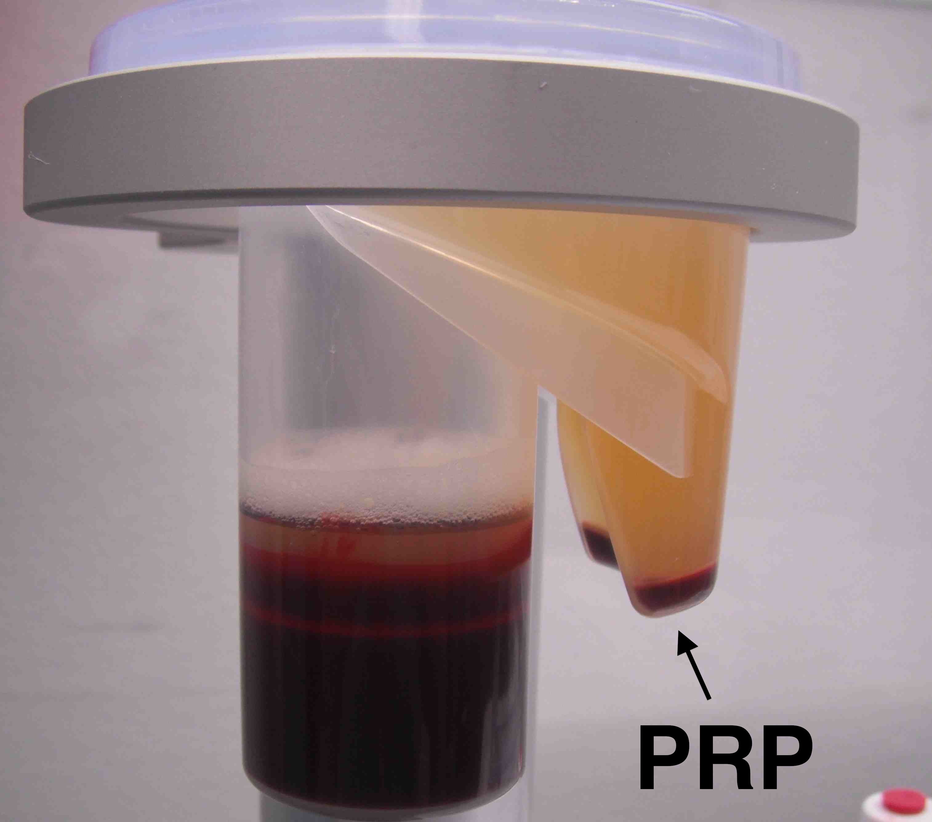 PRP 3